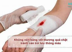 Có Nên Băng Vết Thương Hở Không