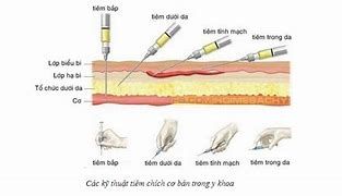 Vị Trí Tiêm Bắp Cho Trẻ Em